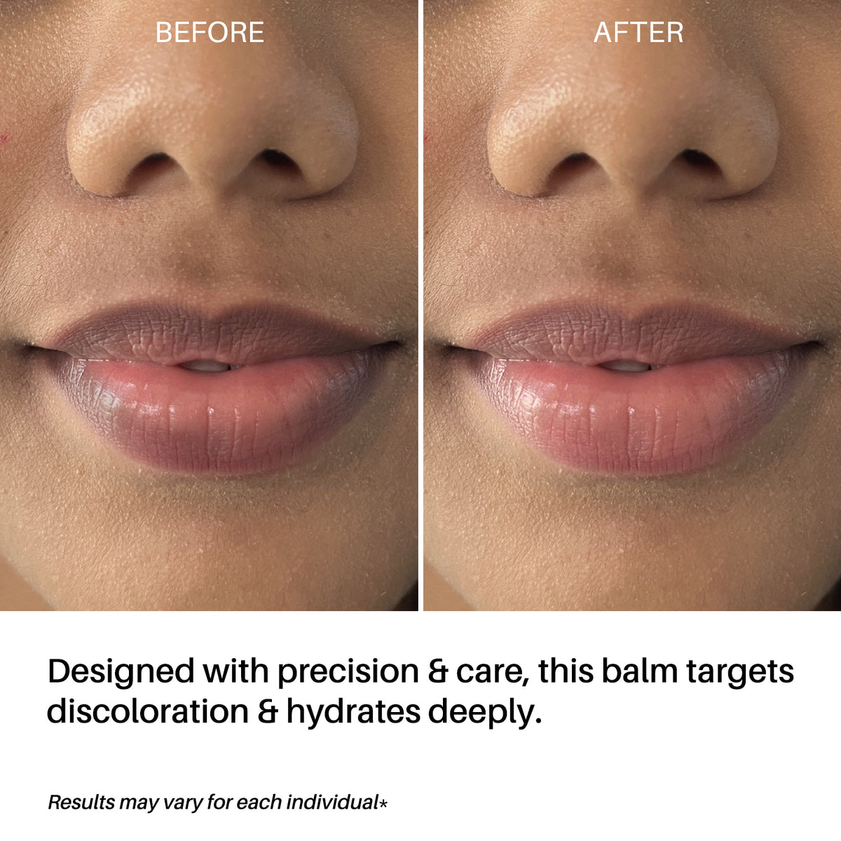 glutathione lip lightening balm DERMDOC LipBright Treatment 1% Glutathione + 2.5% Arbutin Lip Balm (10–  GoNari