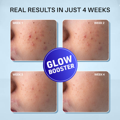 DERMDOC 2% Kojic Acid Glow Fusion Formula Night Cream (25 gm) | Skin Brightening I Targets Pigmentation I With Niacinamide & Alpha Arbutin