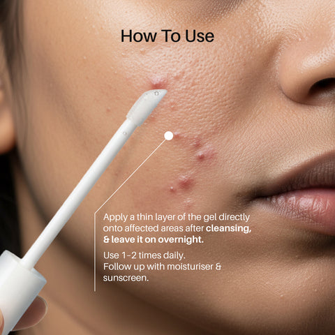 DermDoc 2% Salicylic Acid Pimple Gel (8 ml)