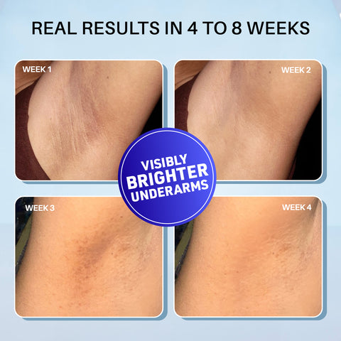 DERMDOC by Purple 5% Glycolic Acid Underarm Brightening Spray Treatment (55 ml) | Exfoliating & Brightening | MultiPurpose Spray for Hyperpigmentation, Dark Spots, Dark Neck, Dark Underarms & Strawberry Legs