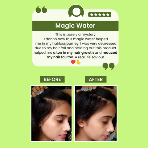 Alps Goodness Rosemary Water Refill Pack (305 ml) | Boosts Hair Growth | Reduces Hair Fall | Hair Spray for Hair Growth | Viral Rosemary Water