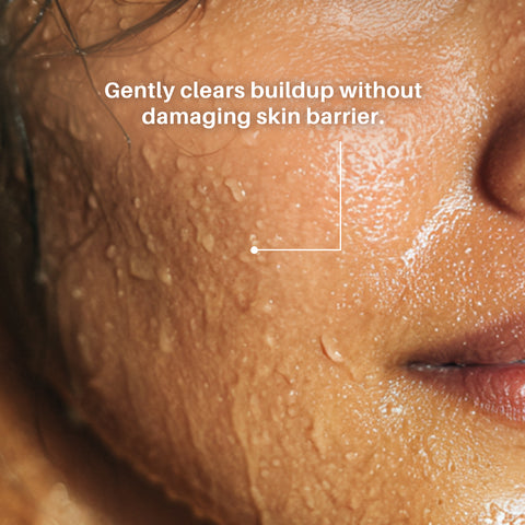 DERMDOC by Purplle 4% Niacinamide Face Wash (120 ml)