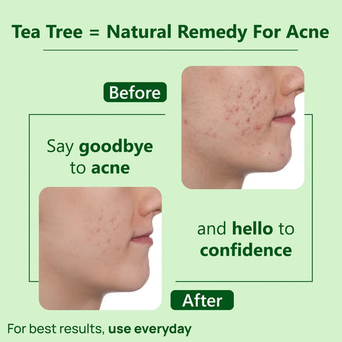 Good Vibes Tea Tree Oil Control Light Gel Creme | Anti-Acne, Hydrating, Moisturizing | No Parabens, No Sulphates, No Mineral Oil (50 gm)