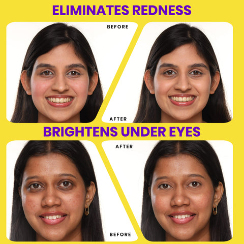 NY Bae HD Spotless Concealer - Golden 04 (11 gm)