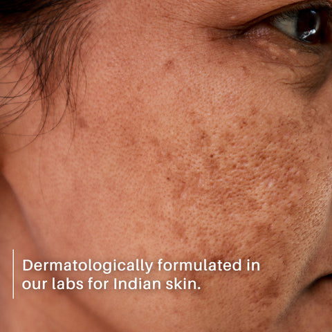 DERMDOC 2% Kojic Acid Face Serum (15 ml) | Brightening & Anti-Pigmentation | Fades Dark Spots, Evens Skin Tone & Enhances Glow