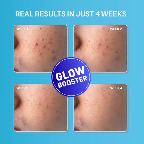 DERMDOC Glowlixir Set | Kojic Acid Glow Fusion Formula Night Cream (50 gm) | Niacinamide Face Serum (15 ml) | Glow | Brightening