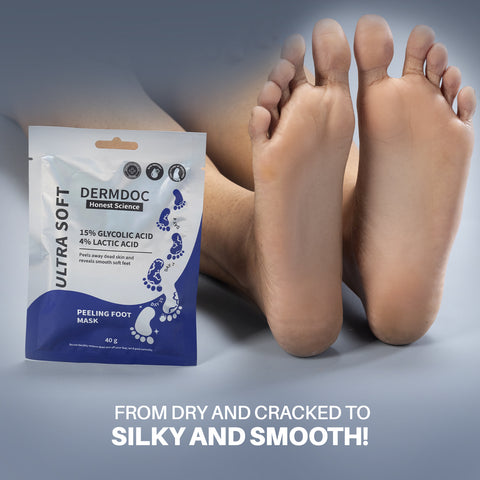 DERMDOC by Purplle 15 % Glycolic Acid & 4% Lactic Acid InstaPedi Foot Peeling Mask (40 gm) | Foot Mask For Baby Soft Feet | Removes & Heals, Dry & Cracked Skin