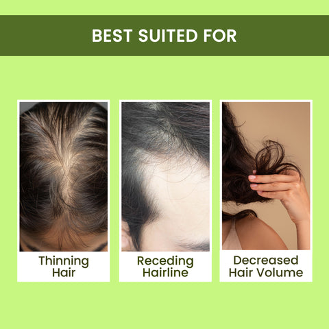 Alps Goodness Rosemary Water (100 ml) | Rosemary water for hair | Hair Spray for Regrowth | Hair Growth Expert | Viral Rinse