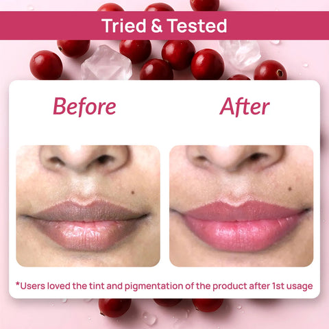 Good Vibes Cranberry Brightening Lip Balm | New & Improved| Ideal for Chapped & Pigmented lips | Brightens lips (5.5 gm)