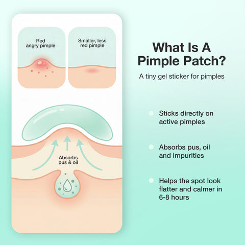 Good Vibes Acne Clear Pimple Patch 36 pcs