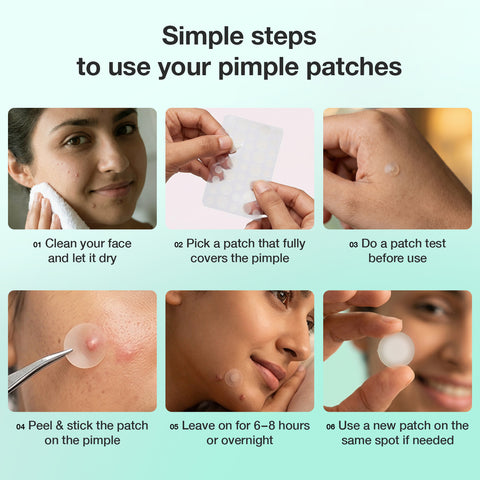 Good Vibes Acne Clear Pimple Patch 36 pcs