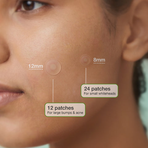 Good Vibes Acne Clear Pimple Patch 36 pcs