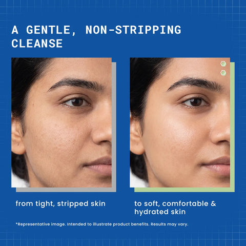 DERMDOC 7% Hydration Complex + 0.3% Vitamin B5 Gentle Face Cleanser | Sulphate-Free Soap-Free Non-Stripping Cleanser | Dry to Normal & Sensitive Skin | Barrier Support & Soft Comfortable Skin | 120 ml