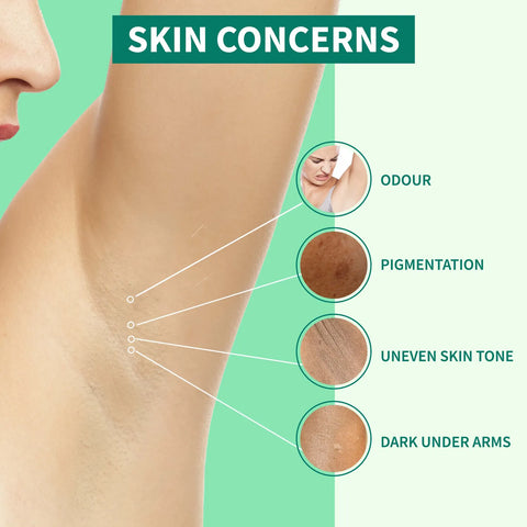DermDoc 5% Glycolic Acid Underarm Treatment (30 ml)
