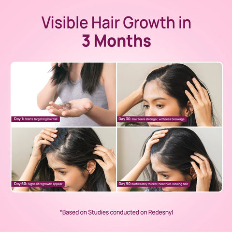 Good Vibes Onion Hair Fall Control Serum with 5X Actives | Onion 0.5% Redensyl Biotin Fenugreek & Green Tea| Lightweight & Non-Sticky | Strengthens Roots | Promotes Hair Growth | Visible Growth in 3 Months | Best Results with Daily - 50 ml