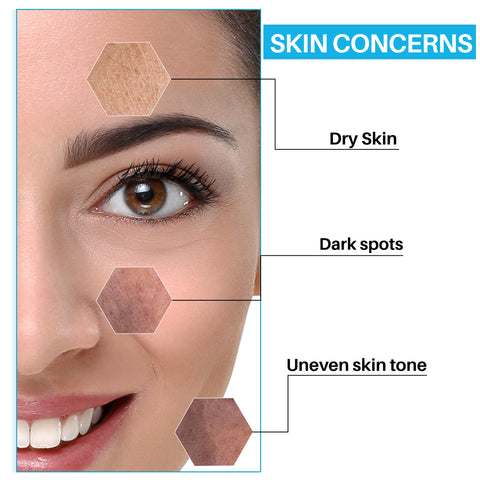 dermdoc-10-percentage-niacinamide-face-serum-for-all-skin-types-15-ml-4