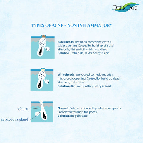 dermdoc-anti-acne-facial-kit-with-salicylic-acid-34-g-6